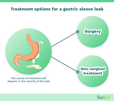 How to Detect Common Gastric Sleeve Leak。